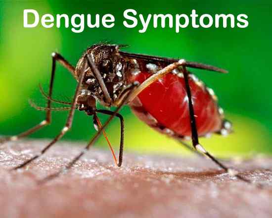 dengue symptoms